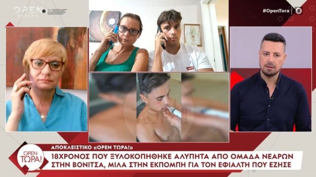 «Τρώω από τη σύριγγα»: Συγκλονίζει ο 18χρονος για τον άγριο ξυλοδαρμό του