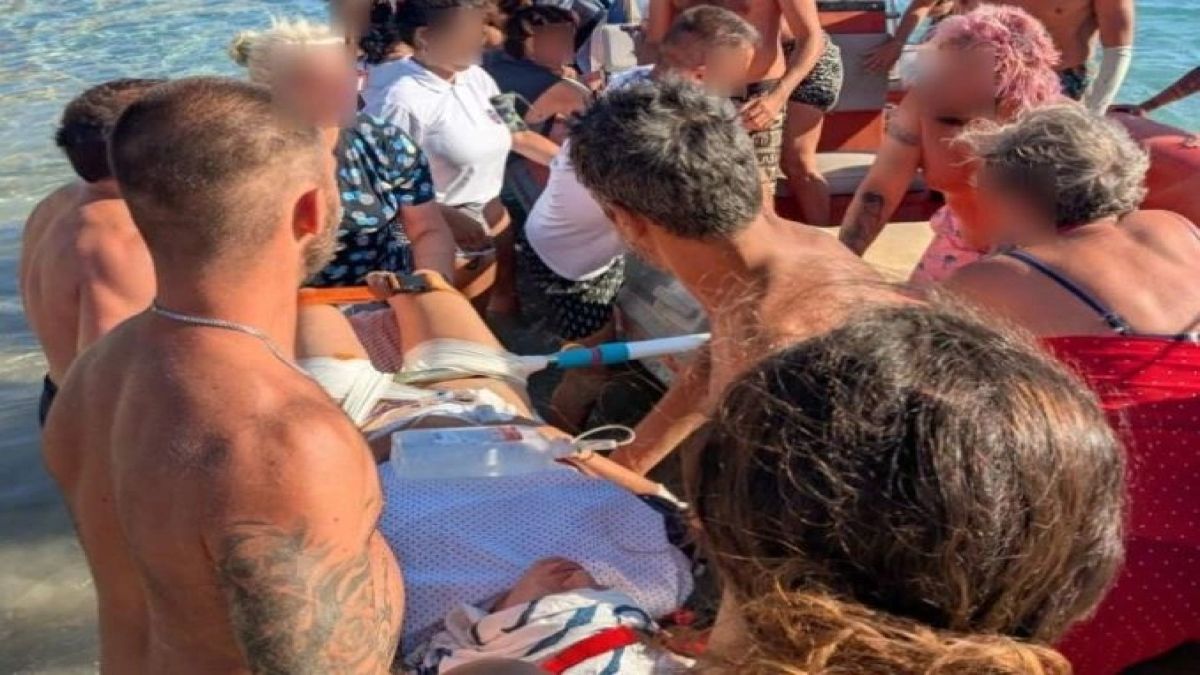 Δονούσα: Λουόμενη τραυματίστηκε σοβαρά από ομπρέλα που εκσφενδονίστηκε από τον άνεμο και κατέληξε στους μηρούς της