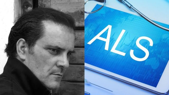 ALS: Τι είναι η νόσος της αμυατροφικής πλευρικής σκλήρυνσης από την οποία έπασχε ο Μιχελής – Τα συμπτώματα και η εξέλιξή της