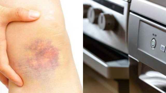 Σοκ: Δείτε ποια οικιακή συσκευή προκαλεί καρκίνο