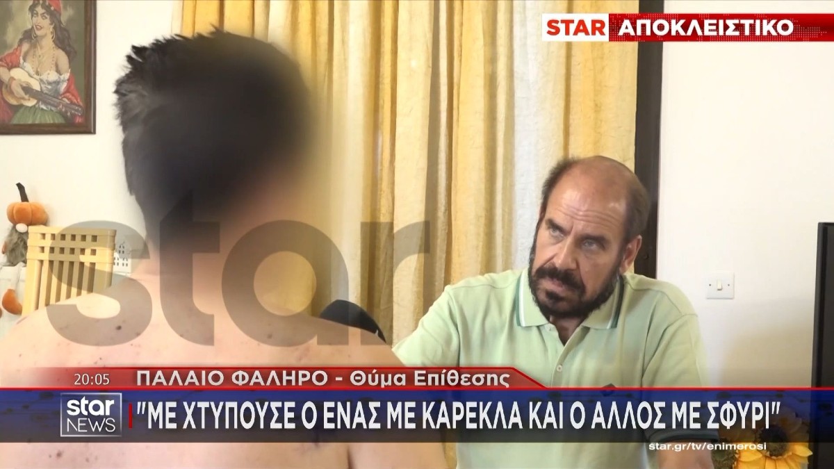 «Ζω από τύχη»: Ξυλοκόπησαν άγρια και λήστεψαν διανομέα φαγητού στο Παλαιό Φάληρο