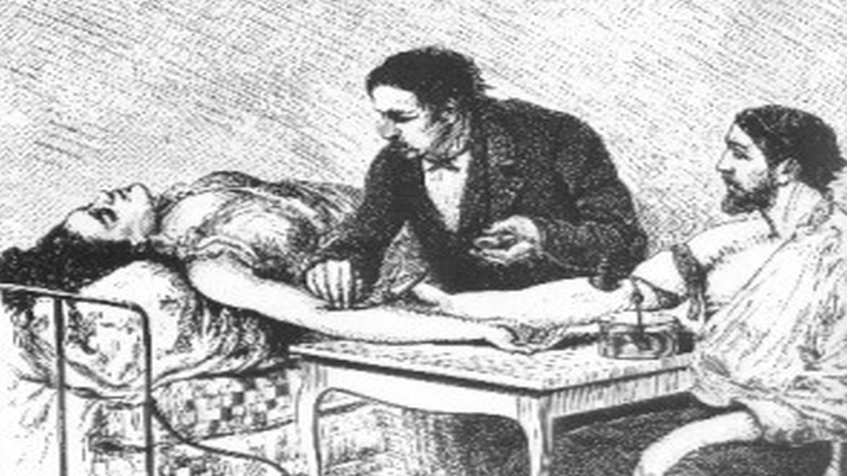 Σαν σήμερα, 25 Σεπτεμβρίου 1818: Η μέρα που η ιατρική άλλαξε για πάντα – Η πρώτη μετάγγιση ανθρώπινου αίματος