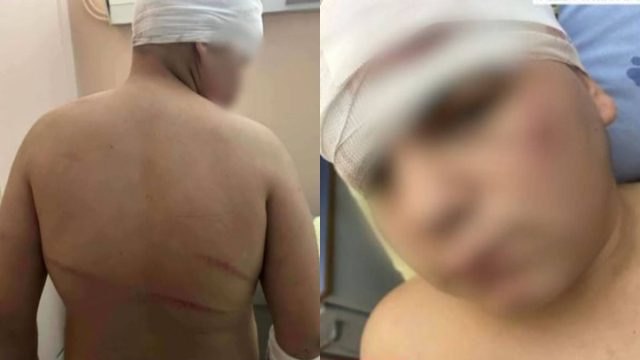 «10-15 άτομα όρμηξαν σε ένα παιδί 13 ετών»: Ξεσπά ο πατέρας του ανήλικου που ξυλοκοπήθηκε στη Θεσσαλονίκη