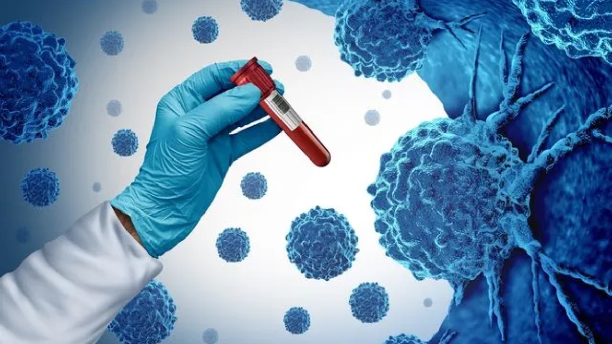 Μελέτη αποκαλύπτει ότι COVID-19 και γρίπη «ξυπνούν» και πολλαπλασιάζουν καρκινικά κύτταρα