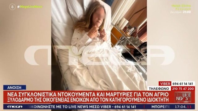 Άνοιξη: Συγκλονιστική εικόνα της ηλικωμένης που ξυλοκοπήθηκε – Ντοκουμέντο με τις καταβολές ενοικίων