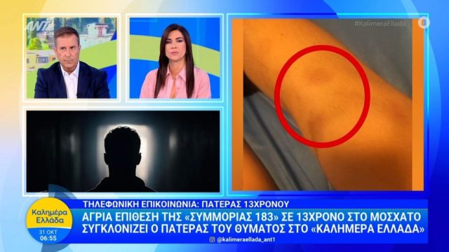 «Από μία κουβέντα ξεκίνησε»: Συγκλονίζει ο πατέρας του 13χρονου που ξυλοκοπήθηκε από συμμορία ανηλίκων στο Μοσχάτο