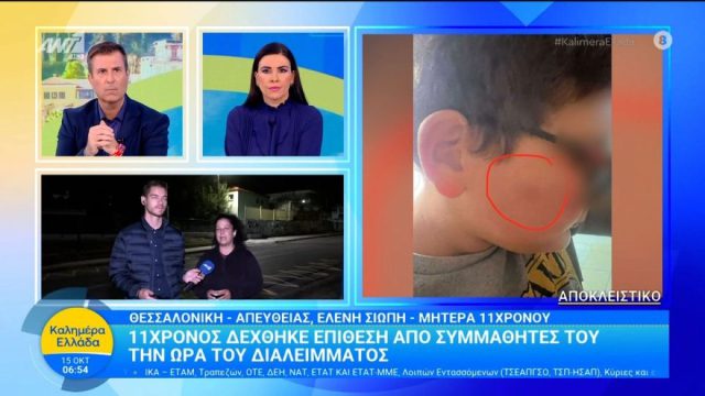 Αδιανόητο σκηνικό bullying στη Θεσσαλονίκη: 11χρονος ξυλοκοπήθηκε από συμμαθητές του – «Η διευθύντρια μου είπε να του μάθω να μην δίνει σημασία»