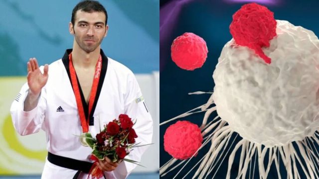 Τι είναι το καρκίνωμα NUT από το οποίο πέθανε ο Αλέξανδρος Νικολαΐδης; Τα συμπτώματα και πώς σχηματίζεται