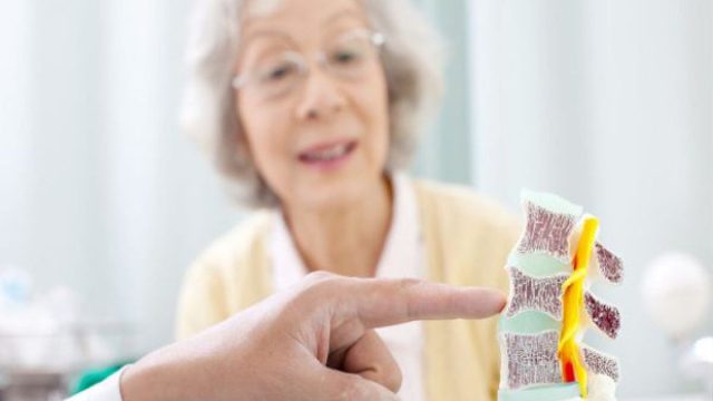 Παγκόσμια Ημέρα Οστεοπόρωσης: Η τροφή που μπορεί να μειώσει τον κίνδυνο