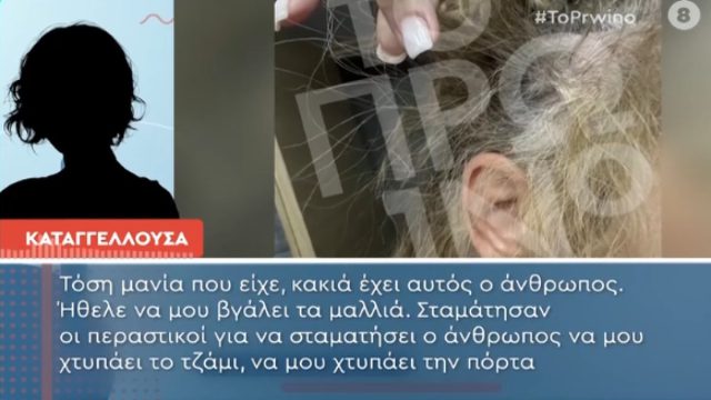 «Έχουν κοπεί τα μαλλιά μου από τη δεξιά πλευρά»: 43χρονη έπεσε θύμα ξυλοδαρμού στη μέση του δρόμου από πλαστικό χειρούργο