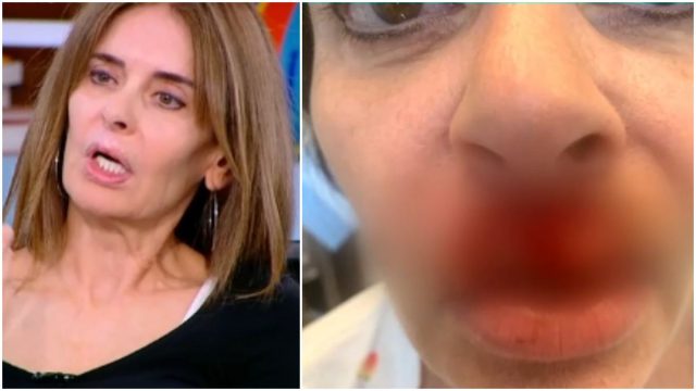«Δεν μπορώ να κλάψω, να φιλήσω, να γελάσω»: Συγκλονίζουν τα λόγια της Κατερίνας Πλουμιδάκη μετά την αποτυχημένη πλαστική