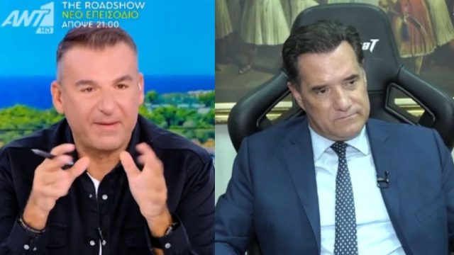 «Το παράκανες ρε παιδί μου, υπερβολικό μαλλί έβαλες» – Το χιούμορ του Λιάγκα για την εμφύτευση του Άδωνι