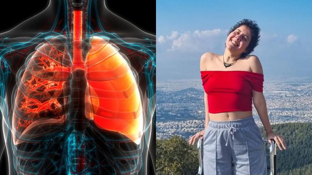 Κυστική Ίνωση: Ποια είναι η σπάνια κληρονομική νόσος με την οποία πάλευε η Αναστασία Τασούλα