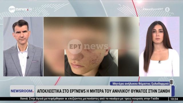 Ξάνθη: 15χρονος γρονθοκοπήθηκε με μπουνιές και κλωτσιές στο κεφάλι – «Νόμιζα ότι ενοχλείς την κοπέλα μου»
