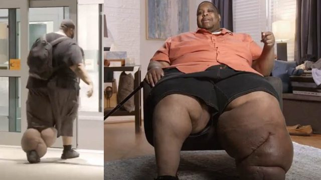 «Dangerously Obese»: Ολική μεταμόρφωση άνδρα που ζύγιζε 272 κιλά – Είχε βγάλει έναν τεράστιο όγκο στο αριστερό του πόδι