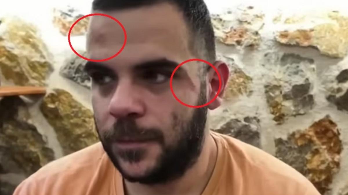 Σοκ: Χτύπησαν άγρια Youtuber σε live μετάδοση στα Γιάννενα – Εμφανίστηκε με μελανιές (video)