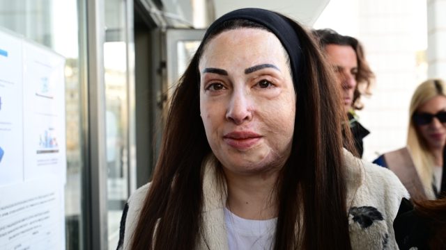 Ιωάννα Παλιοσπύρου: Η συγκλονιστική ανάρτηση για τα σημάδια της επίθεσης με βιτριόλι – «Με ρωτάς πώς αντέχω…»