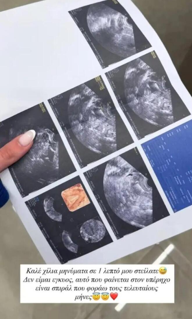 Το επίμαχο story της Ιωάννας Τούνη από τον γυναικολόγο