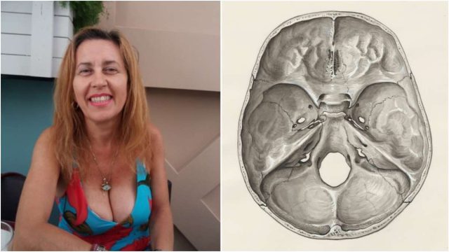Πέθανε από εγκεφαλικό η καθηγήτρια Σοφία Χρηστίδου: Τα 6 προειδοποιητικά σημάδια που σώζουν ζωές