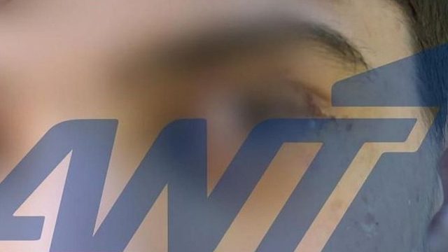 Σοκ στα Ιωάννινα: Μόνιμη βλάβη στο μάτι 16χρονου μετά από άγριο ξυλοδαρμό – Στο «κάδρο» ηθικός αυτουργός