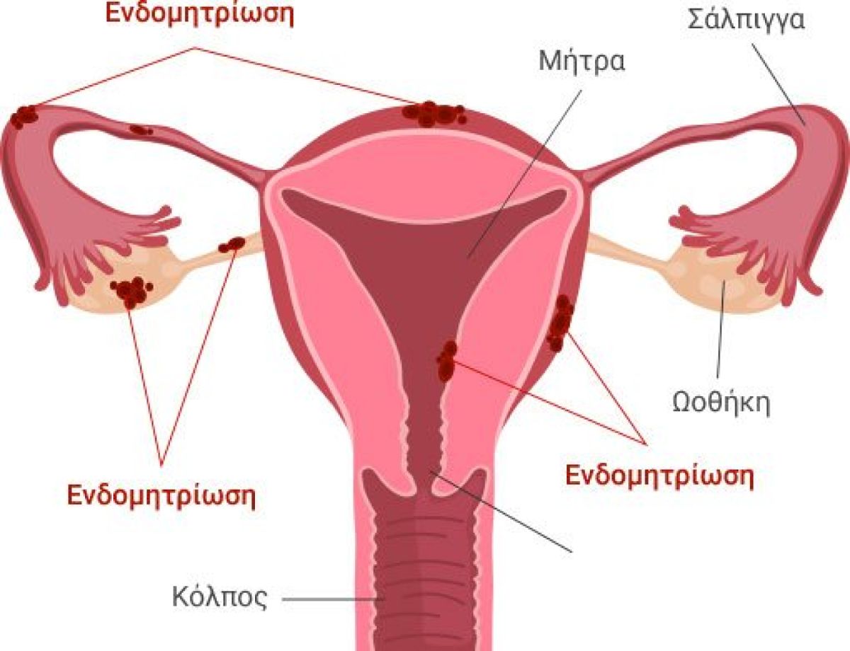 Η νέα εξέταση που μπορεί να μειώσει τα χρόνια αναμονής για διάγνωση