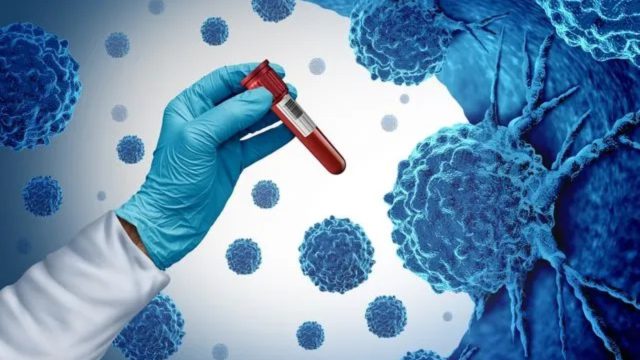 Νέα μελέτη «καμπανάκι»: Βαριά λοίμωξη από Covid ή γρίπη μπορεί να αυξήσει τον κίνδυνο καρκίνου του πνεύμονα