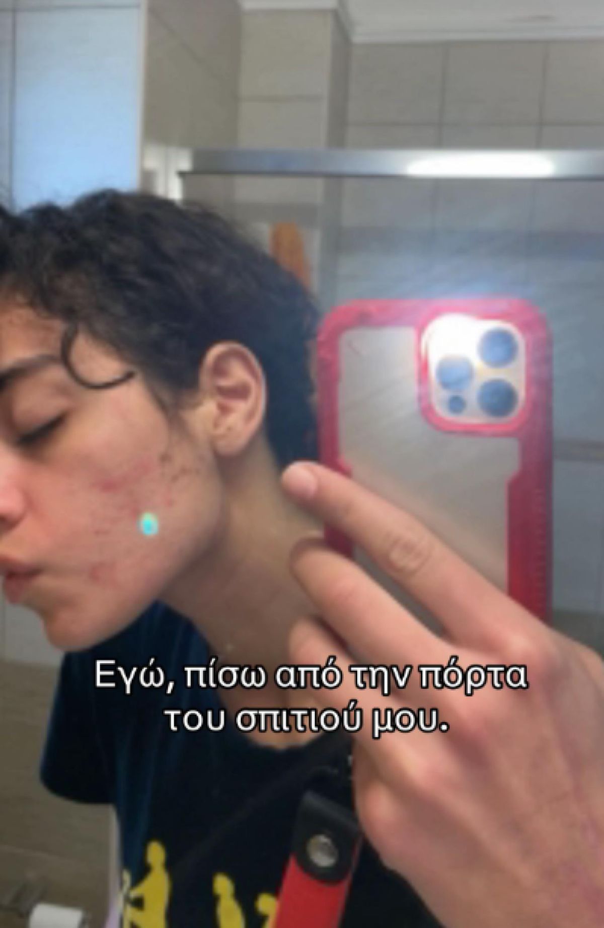 Screenshot από εφαρμογή TikTok που δείχνει μια από τις φωτογραφίες-ντοκουμέντο με σημάδια κακοποίησης, καλυμμένη με προειδοποίηση περιεχομένου