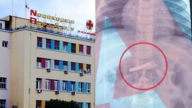 Απίστευτο – Αθήνα: Μεγάλη αγωνία για αγοράκι 3 ετών που κατάπιε ξυράφι – Τα νεότερα για την κατάσταση του