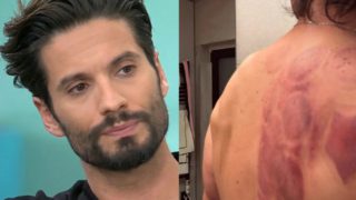 Δύσκολες στιγμές για τον Γιώργο Καράβα: Αποκάλυψε το πρόβλημα που έχει στην ωμοπλάτη – Το δημόσιο μήνυμα και οι ευχές για γρήγορη ανάρρωση