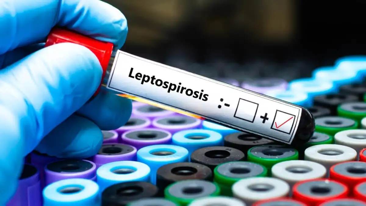 Σε κατάσταση συναγερμού βρίσκεται η Ζάκυνθος λόγω της έξαρσης κρουσμάτων Λεπτοσπείρωσης στο νησί.