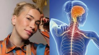 Η Αμάντα Μανωλάκου δίνει μάχη με την σκλήρυνση κατά πλάκας – Τι ακριβώς είναι και πόσο δυσκολεύει την ζωή του ασθενούς