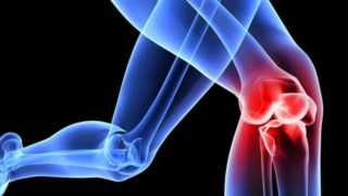 Οστεοαρθρίτιδα: 12 μύθοι και παγίδες που μπερδεύουν τους ασθενείς – Τι ισχύει πραγματικά για μια από τις πιο επώδυνες εκφυλιστικές παθήσεις των αρθρώσεων