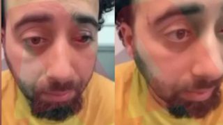 Άγριο ξύλο στην Παλλήνη για 3 ευρώ: Αυτό είναι το θύμα της αποτρόπαιας επιθέσης – Βίντεο με την καταγγελία του