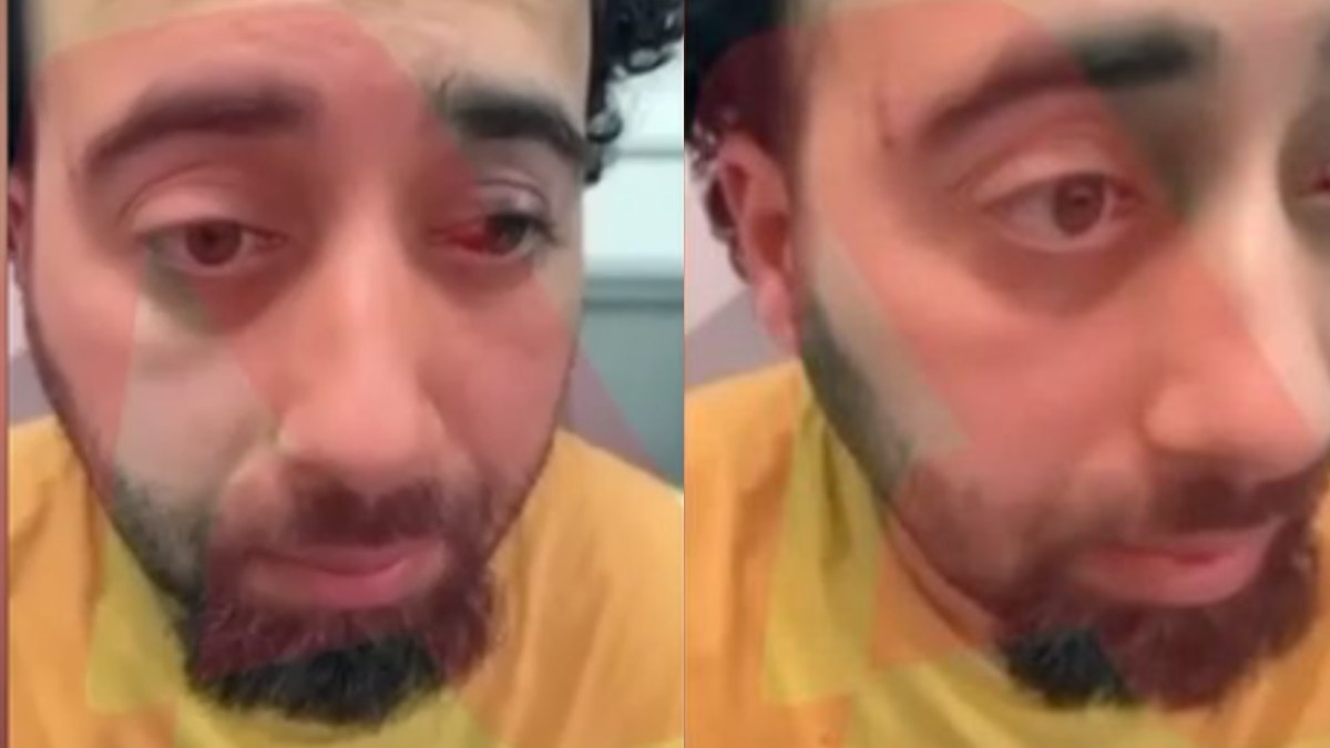Άγριο ξύλο στην Παλλήνη για 3 ευρώ: Αυτό είναι το θύμα της αποτρόπαιας επιθέσης – Βίντεο με την καταγγελία του