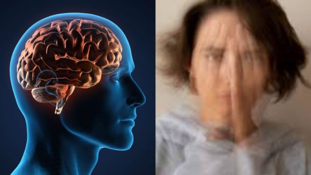 Ερευνητές εντόπισαν το «κλειδί» της σχιζοφρένειας: Το λάθος κύκλωμα που «παγιδεύει» τον εγκέφαλο
