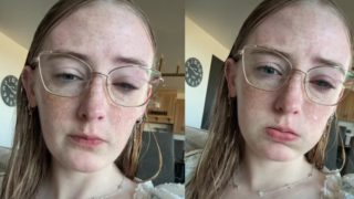 Υγεία: Έκανε μπάνιο με τους φακούς επαφής και έμεινε τυφλή μέσα σε λίγες μέρες – Τα βίντεο της συγκινούν όλο τον πλανήτη