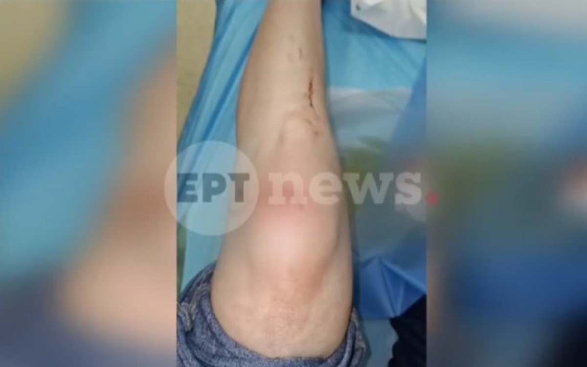 Τα χτυπήματα της γυναίκας.