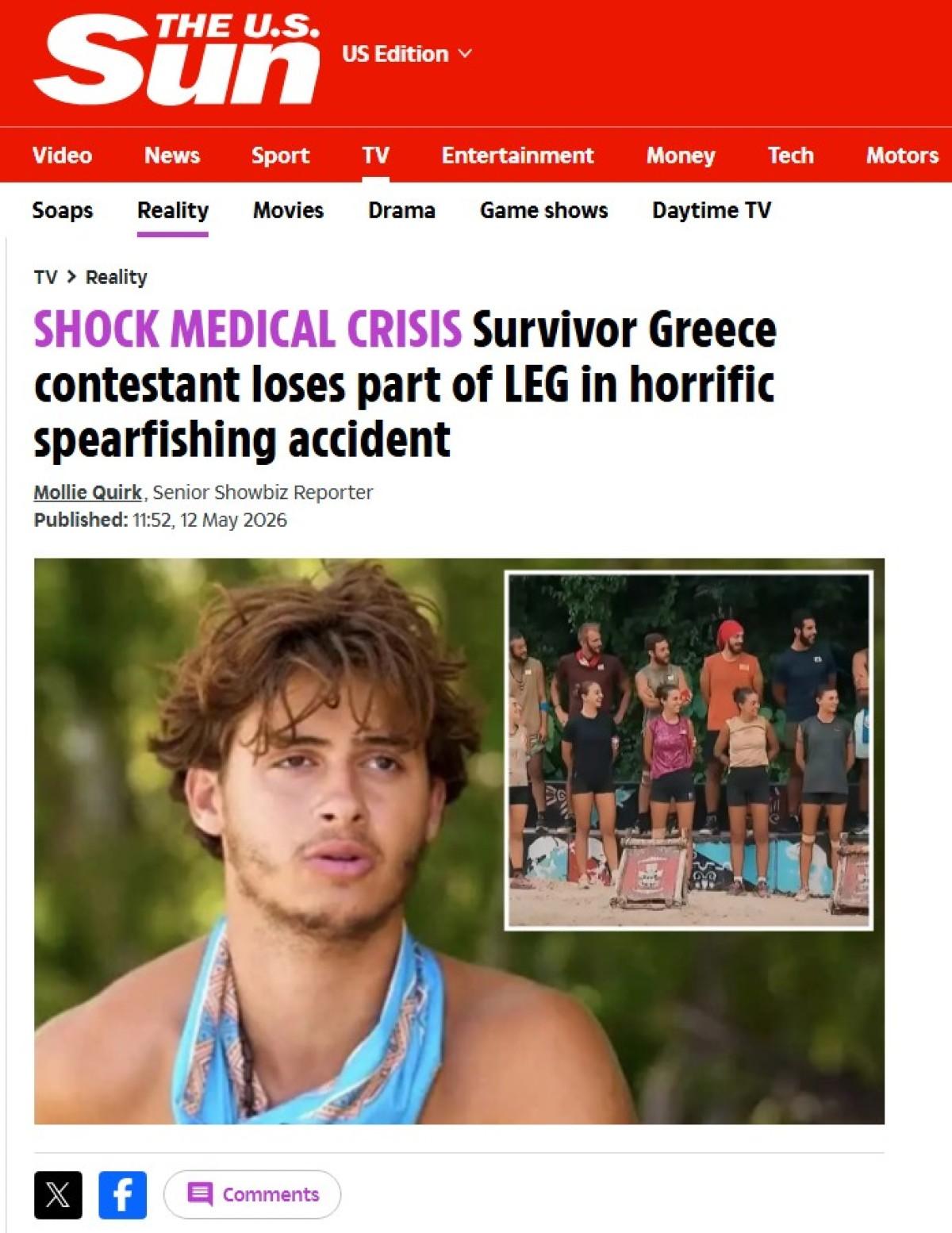 Το ατύχημα του Φλώρου στο Survivor συγκλονίζει διεθνή ΜΜΕ και social media