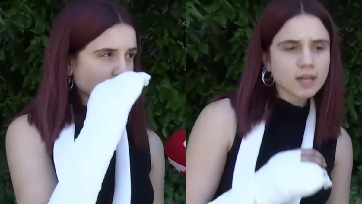 Κουκουλοφόροι στα πανεπιστήμια: Συγκλονίζει τραυματισμένη φοιτήτρια που έπεσε θύμα ξυλοδαρμού (βίντεο)