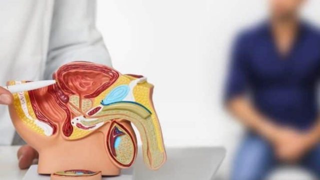Καρκίνος προστάτη: Νέα μελέτη δείχνει ότι ο προληπτικός έλεγχος μειώνει τη θνησιμότητα