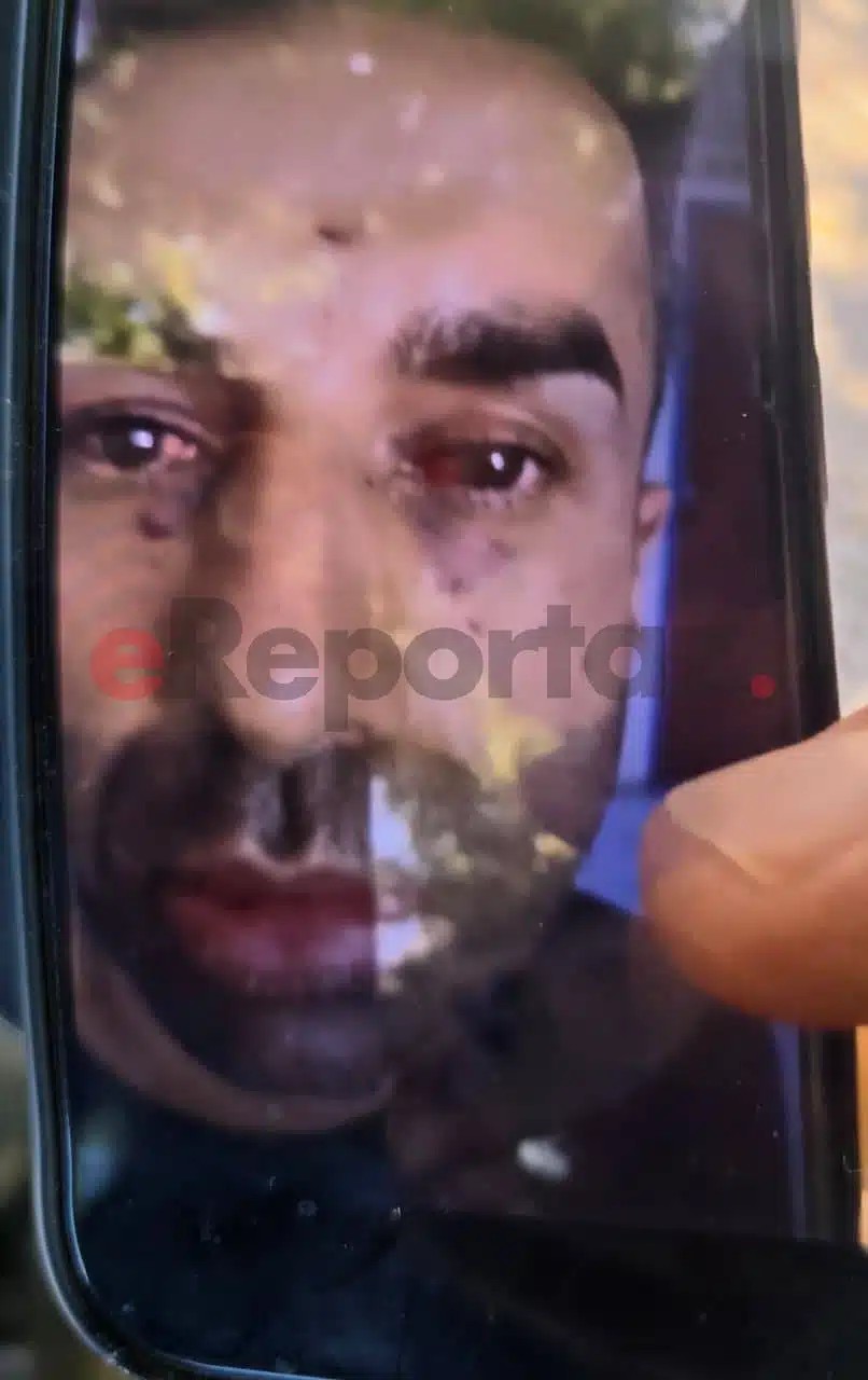 Πηγή εικόνας: e-reportaz.gr
