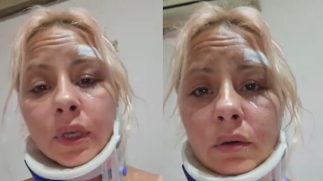 Συγκλονίζει θύμα τροχαίο μέσα από το νοσοκομείο – Την παρέσυραν πεζή και την άφησαν στην μέση του δρόμου με 7 σπασμένους σπόνδυλους 