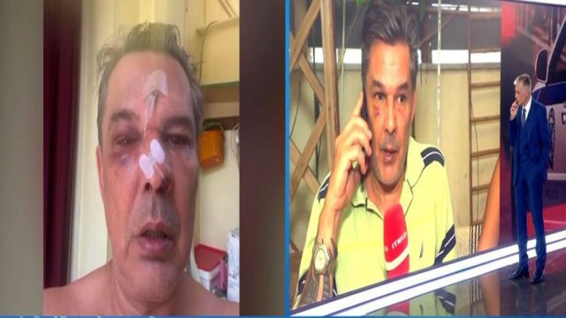 «Μου ‘χει σπάσει το κόκκαλο στη μύτη» – Τι λέει ο άνδρας που έπεσε θύμα ξυλοδαρμού μέσα σε ιατρείο στο Χαϊδάρι