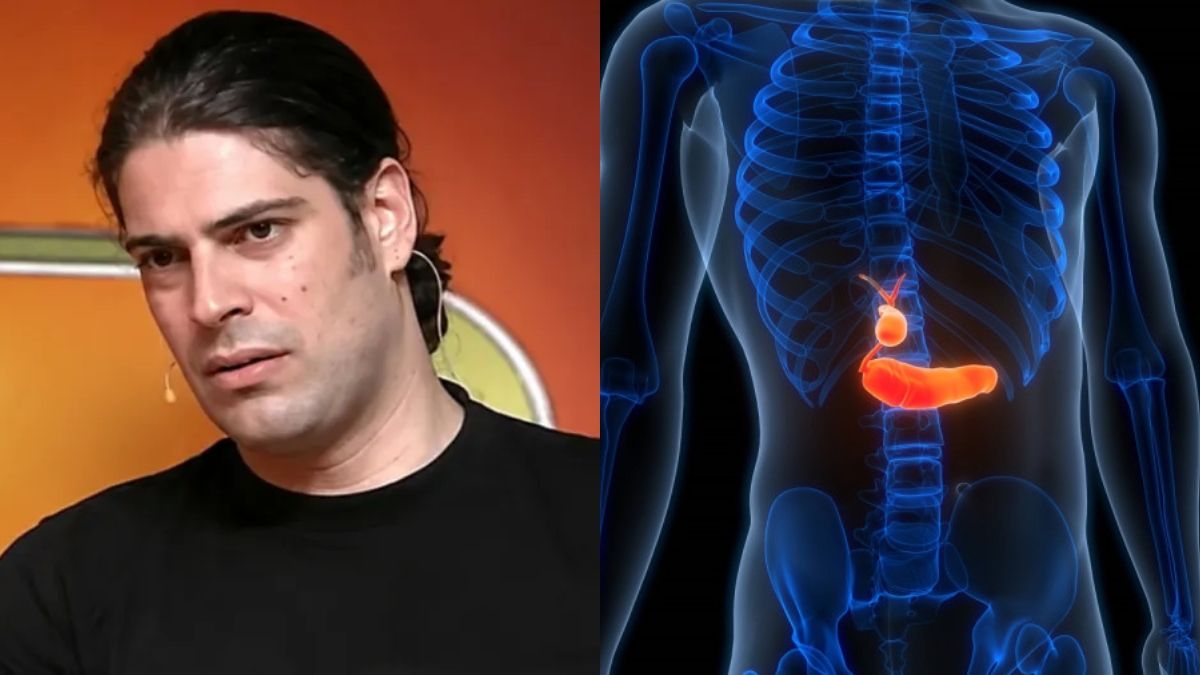 Με αφορμή τον θάνατο του Καριέρε: Οι 7 ενδείξεις του καρκίνου στο πάγκρεας – Ο καρκίνος που δεν δίνει σημάδια μέχρι να είναι αργά