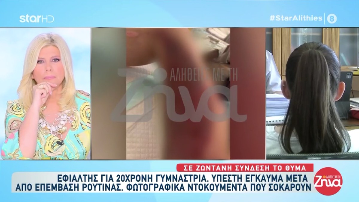 Σοκ στη Θεσσαλονίκη: «Μου έλεγαν ότι είναι παροδικό ενώ είχα εγκαύματα τρίτου βαθμού»