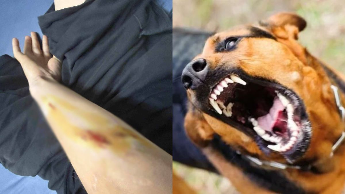 Σκύλος επιτέθηκε και δάγκωσε 12χρονο στο Ηράκλειο – Στο νοσοκομείο το παιδί, συνελήφθη 28χρονη