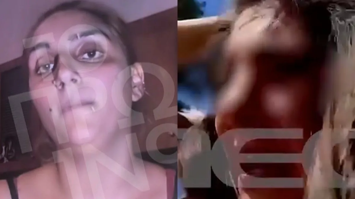«Μια σφαλιάρα έφαγες, γιατί…» – Η μητέρα της 4χρονης μιλά για την υπόθεση στα Άνω Λιόσια (VIDEO)