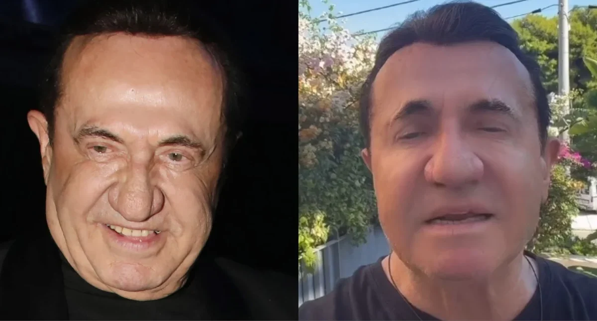 «Ποιος είναι αυτός;»: Παραμορφώθηκε ο Λευτέρης Πανταζής από τις πλαστικές!