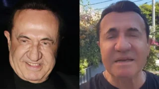 «Ποιος είναι αυτός;»: Παραμορφώθηκε ο Λευτέρης Πανταζής από τις πλαστικές!