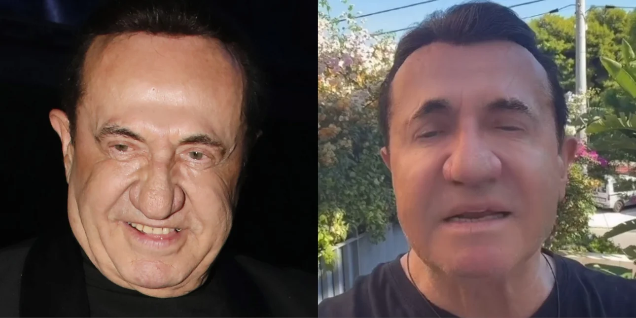 «Ποιος είναι αυτός;»: Παραμορφώθηκε ο Λευτέρης Πανταζής από τις πλαστικές!